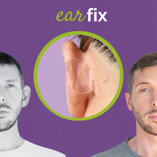Earfix – Il Correttore per Orecchie per Risultati Naturali - cerotto