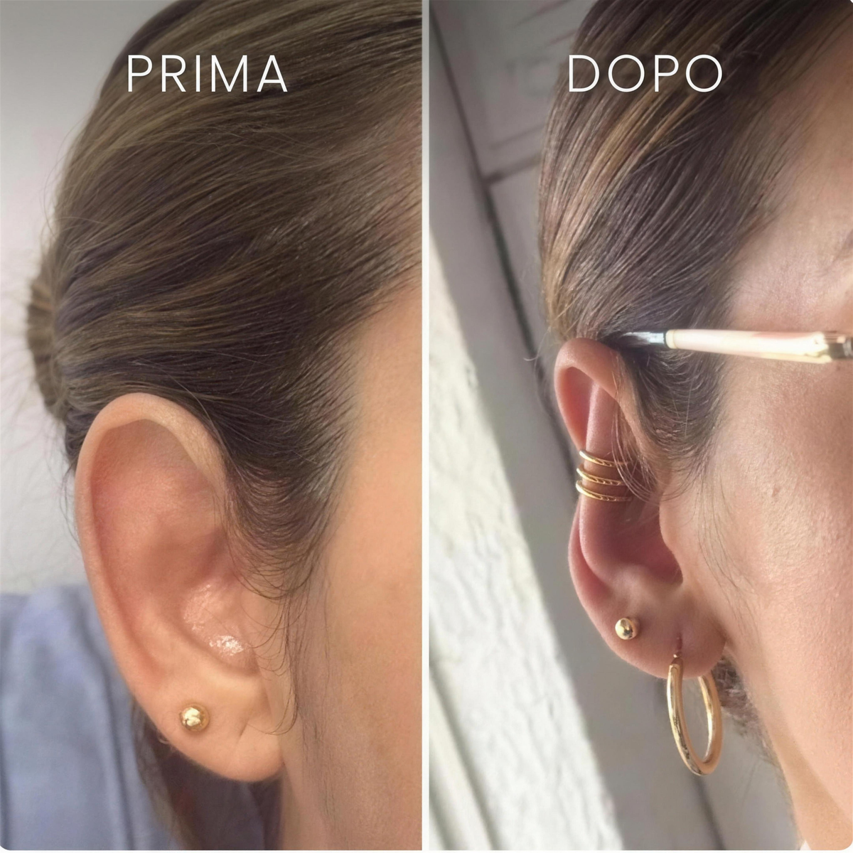 Earfix –  Il Correttore per Orecchie Riutilizzabile a Tre Fasce